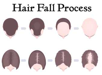 Hair Fall Process