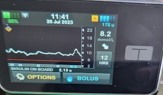 The T Slim X2 insulin pump showing control IQ in use