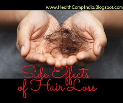 Do you know Side Effects of Hair Loss