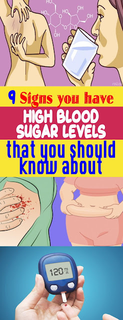 Sure Signs That You Have a High Blood Sugar !