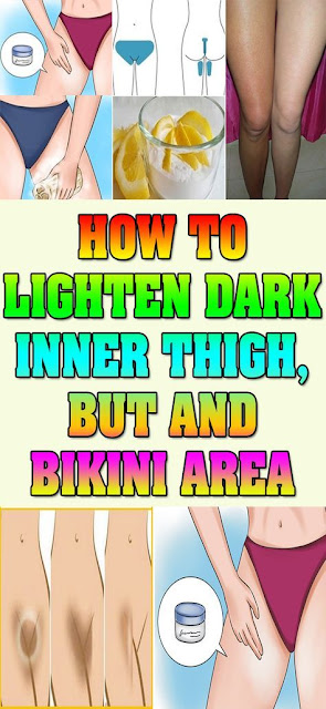 Home Remedies To Lighten Dark Inner Thighs, Butt And Bikini Area