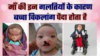 बच्चा विक्लांक क्यो पैदा होता है । Why is a child born disabled । What causes disability in a child? । Can a child be born disabled?