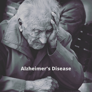 Alzheimer's Disease Dementia 
