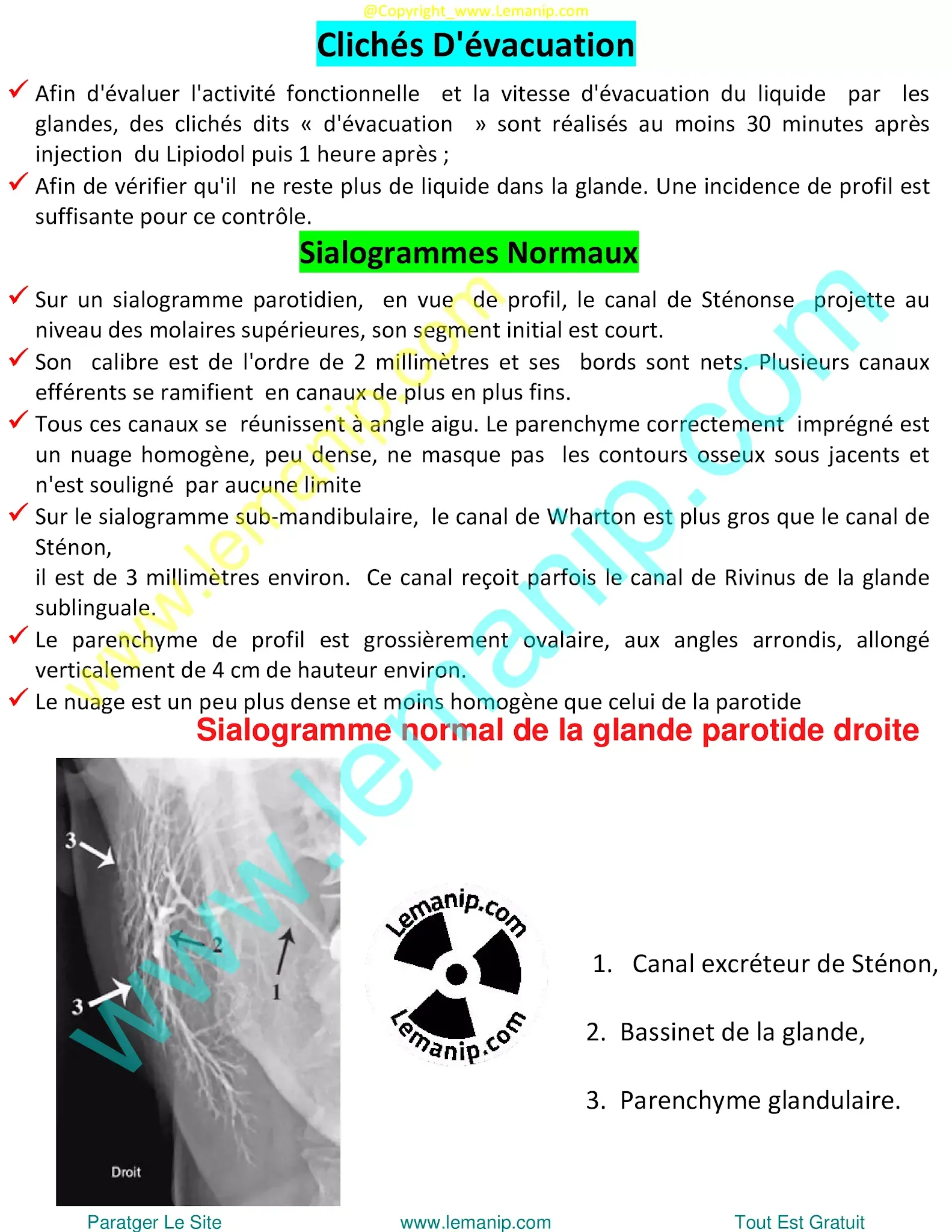 removing salivary gland,sjogren's swollen glands,left parotid,parotid duct,stensen's duct,parotid gland duct,swollen parotid glands both sides,swollen parotid gland on both sides,superficial parotid,inflamed salivary gland