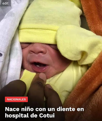SANCHEZ RAMÍREZ: Nace niño con un diente en hospital de Cotui