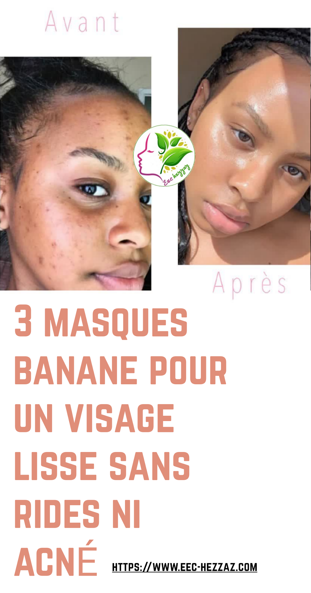 3 masques banane pour un visage lisse sans rides ni acné