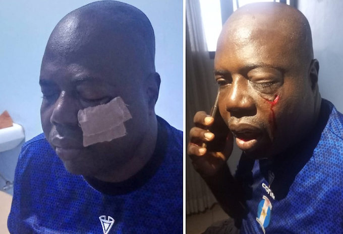 Hoodlums Attack Oyo Sports Council Boss After Shooting Stars’ 1 – 1 Draw Against MFM