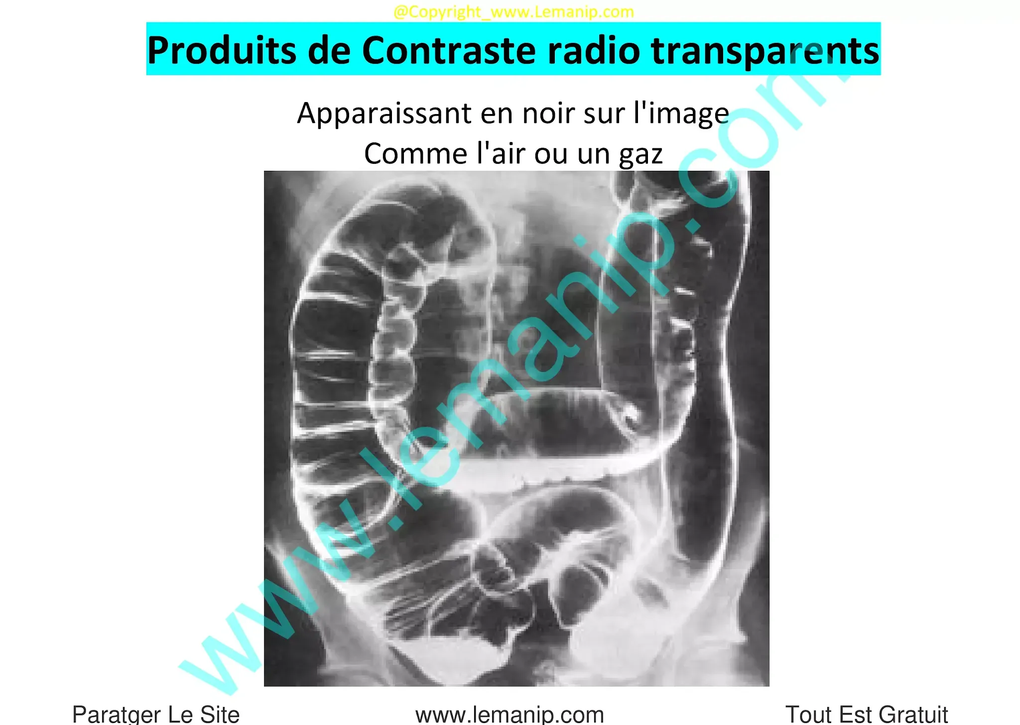 Produits de Contraste radio transparents