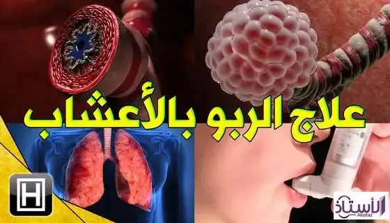 Asthma-herbal-treatment