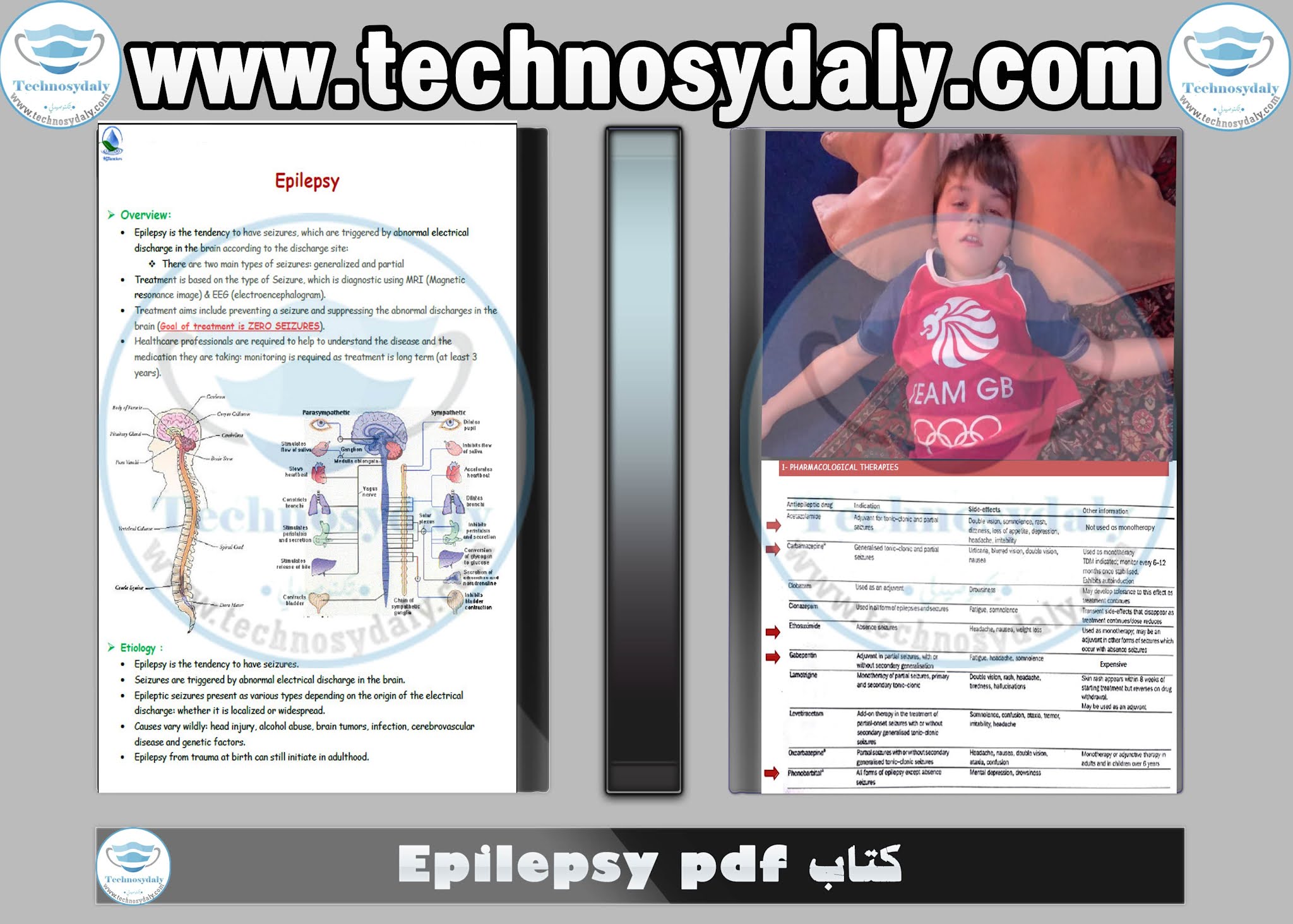 كتاب Epilepsy pdf