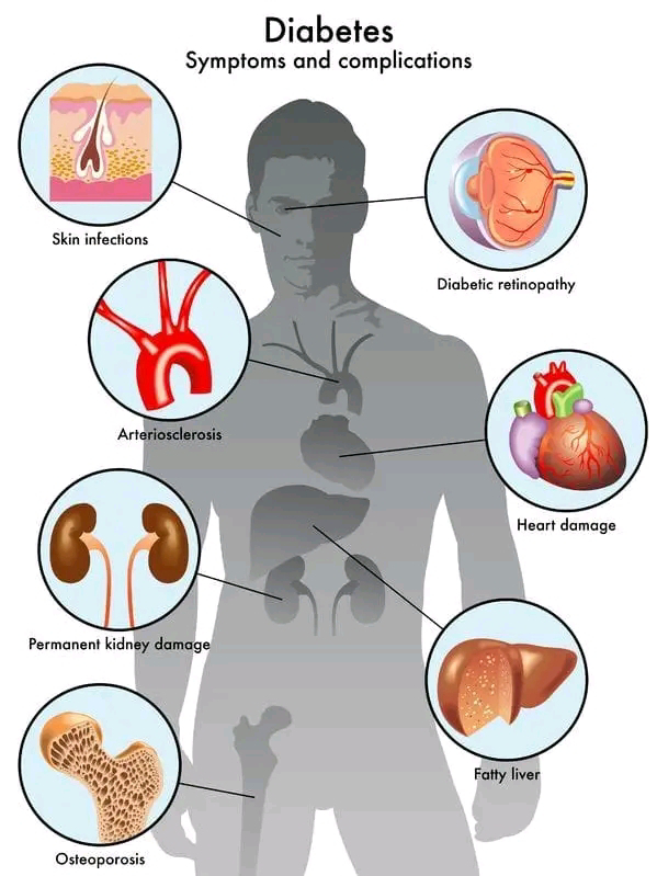 ABINCIN MASU CIWON SUGAR [DIABETICS DIETS]