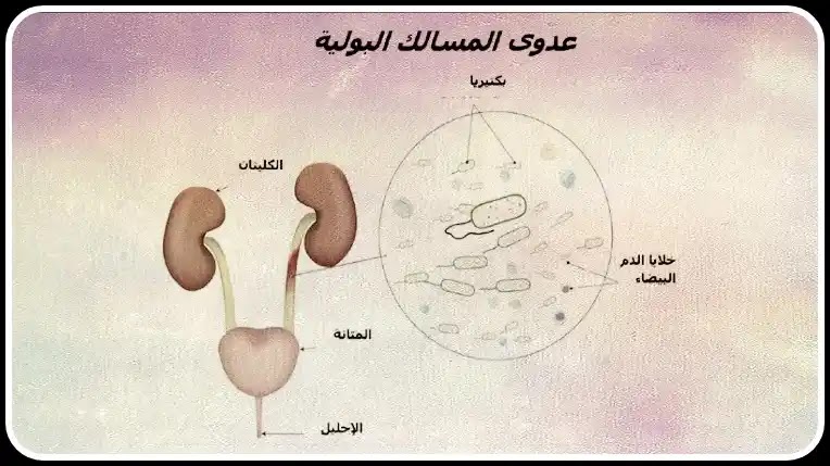 الشاي يساعد في علاج عدوى المسالك البولية