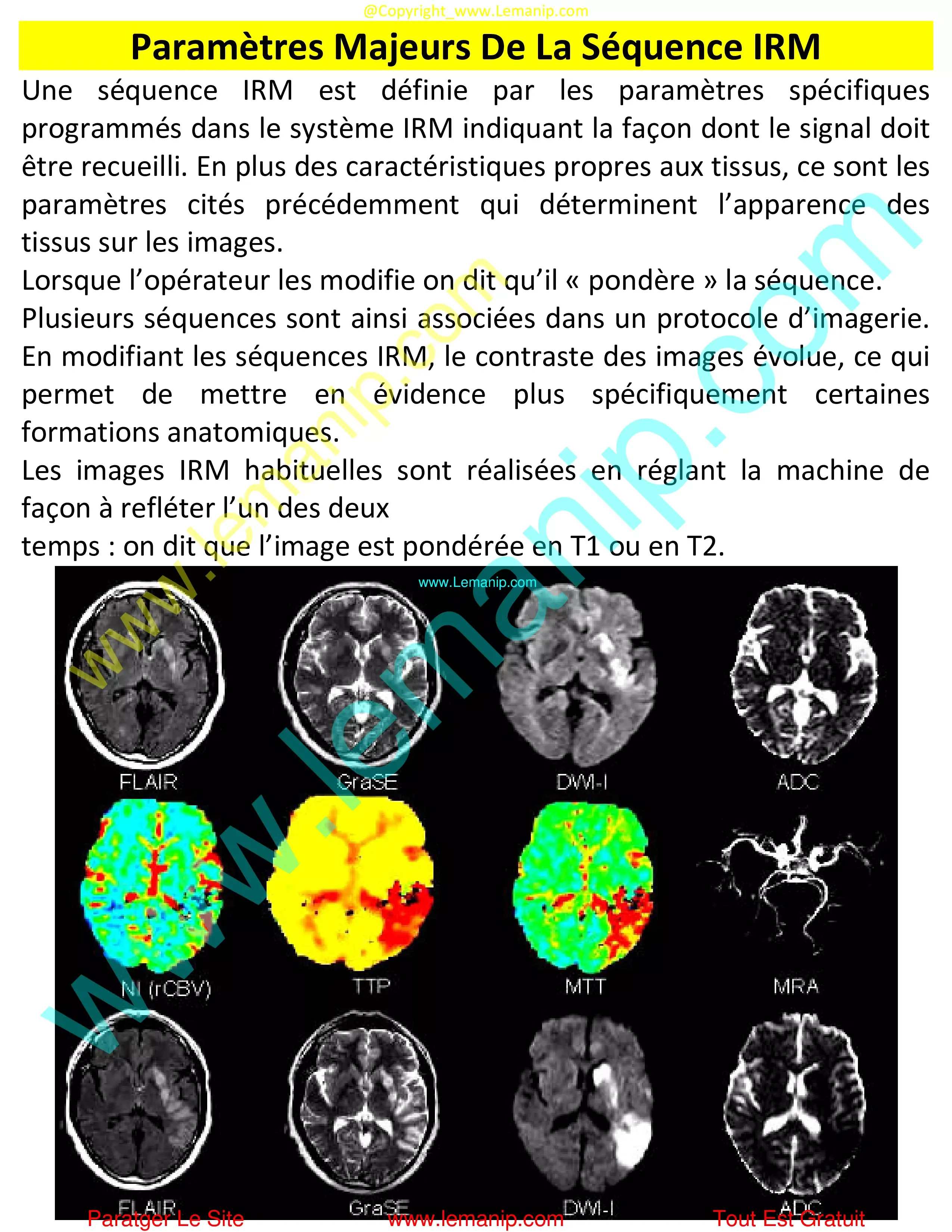 refurbished mri equipment,cost of philips mri machine,arrt mri,head only mri scanner,mri machine magnet,interventional magnetic resonance imaging,mobile mri scanner for sale,small mri machine,mobile mri machine,alat mri