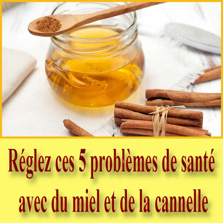 Réglez ces 5 problèmes de santé avec du miel et de la cannelle