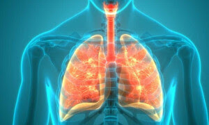 Diagnose lung cancer