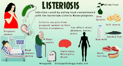 zoonotic importance of listeriosis