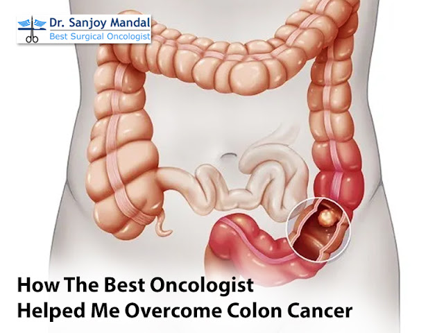 best surgical oncologist in Kolkata