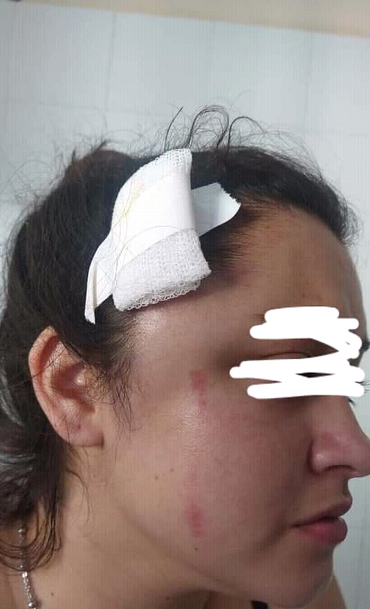 Alberdi: Dos hermanas golpearon a una joven en un boliche 