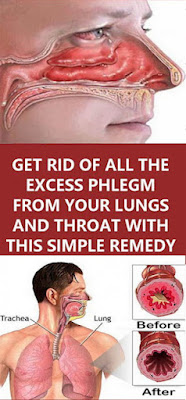 This Simple Remedy Will Get Rid Of All The Excess Phlegm From Your Lungs And Throat