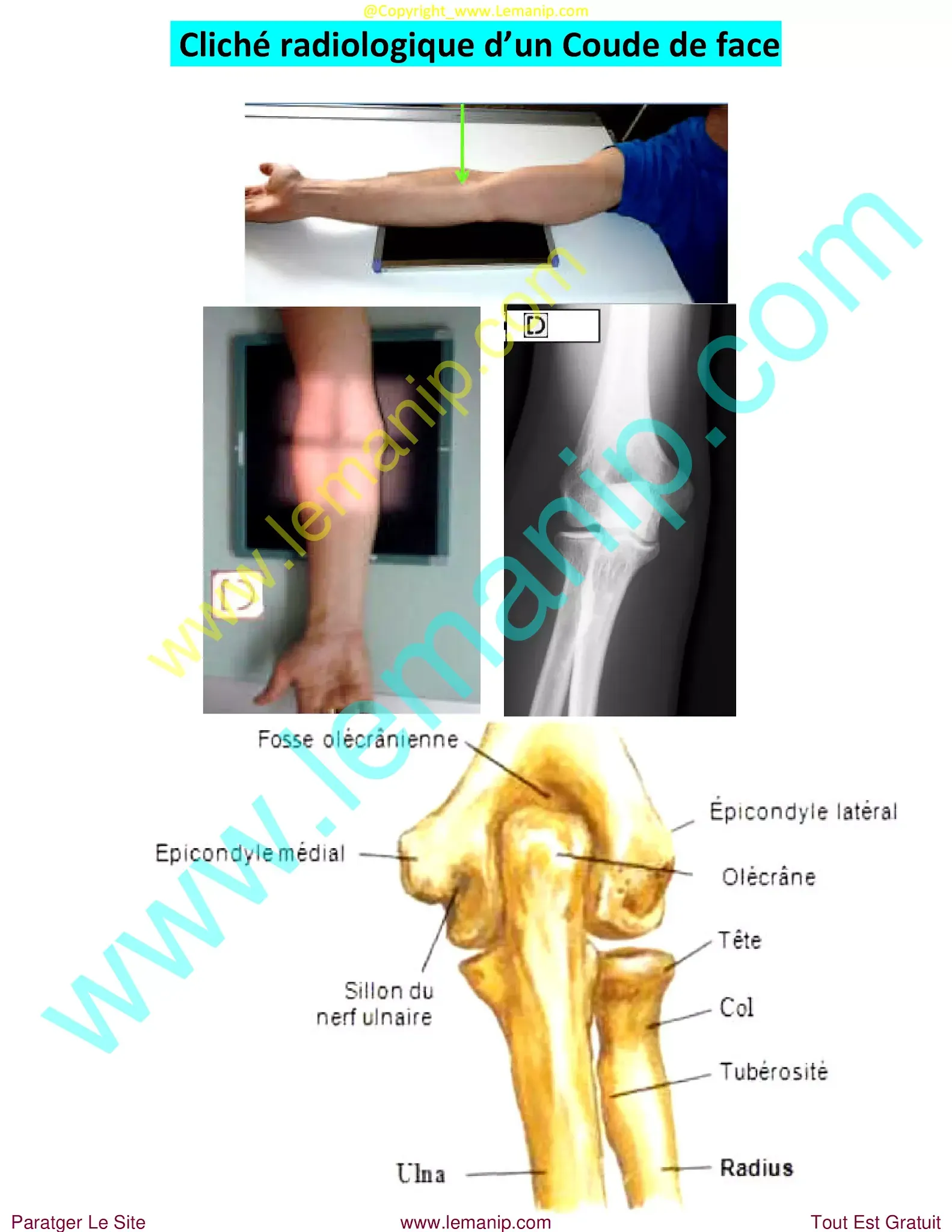 avant bras,elbow pain orthopedic doctor,dr henry hand and wrist,elbow pain treatment near me,premier orthopedics hand specialist,bras avant,hand man,orthopedic hand,orthopedic wrist,orthopedic elbow,orthopedic carpal tunnel