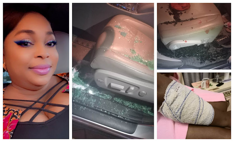 Actress Kemi Afolabi cries out after being attacked by Armed robbers at Lagos-Ibadan expressway (Videos/Photos)