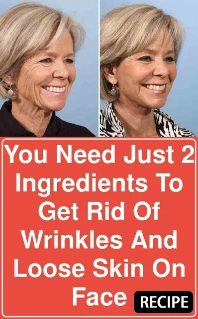 You Need Just 2 Ingredients To Get Rid Of Wrinkles And Loose Skin On Face