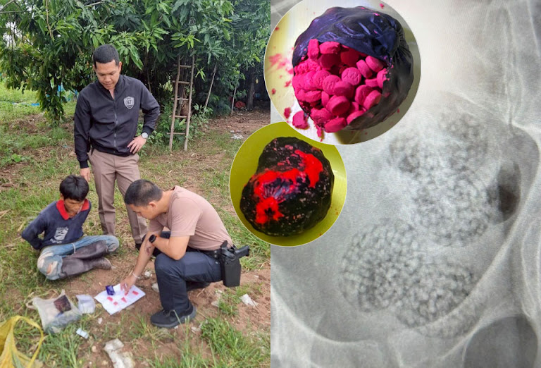 Thailand Drug Ring Snares Austrian Tourist; He Swallows Pills.