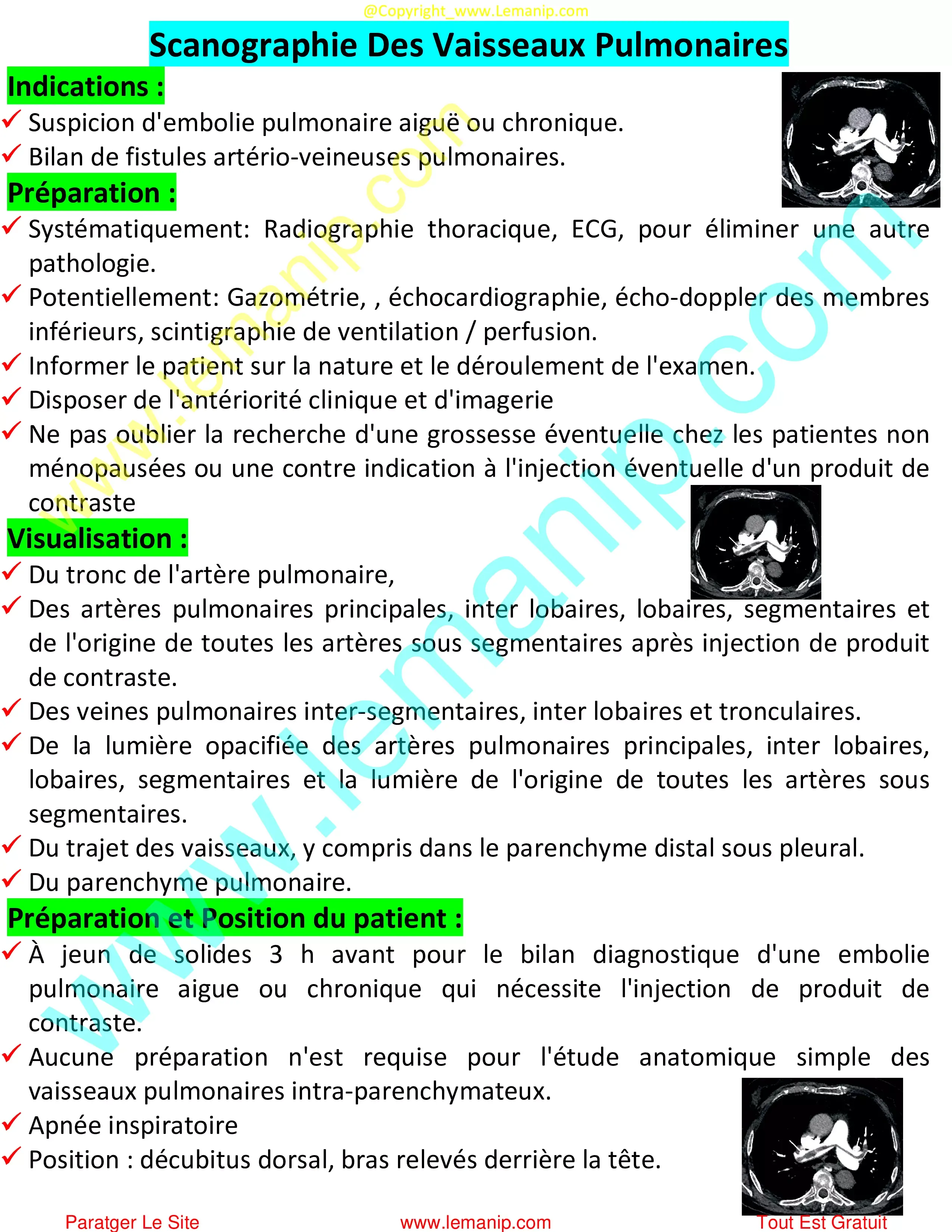 Scanographie Des Vaisseaux Pulmonaires