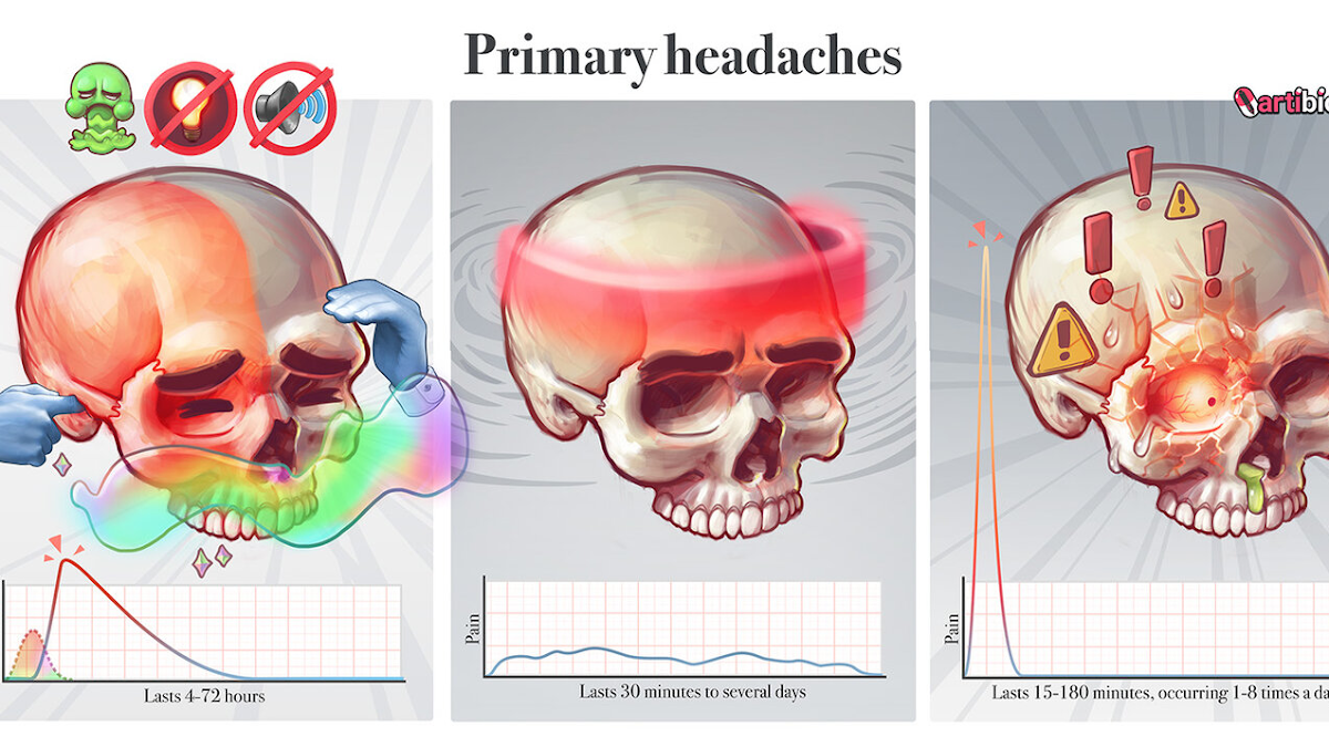 Causes of headache