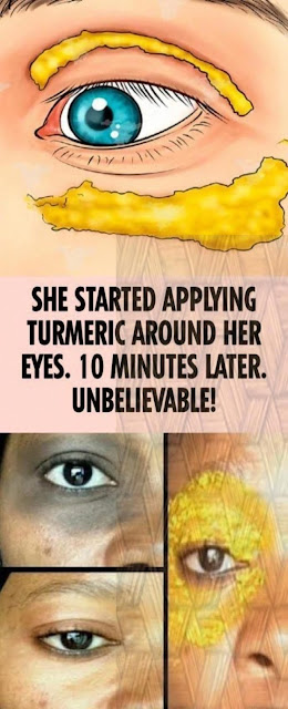 Apply Turmeric Under Your Eyes For This Reason !
