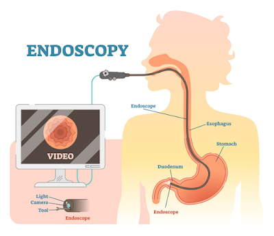 best endoscopy in redding