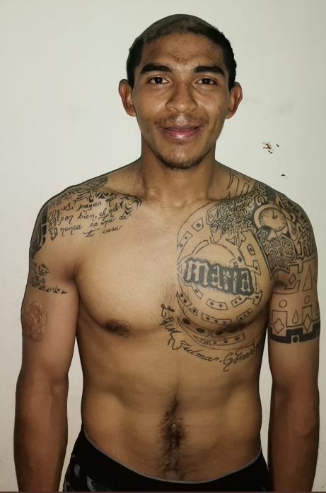 El Salvador: Capturan a pandillero que intentó ocultar los tatuajes de la MS13
