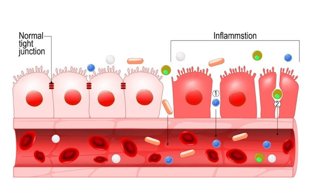 PERMEABILIDAD INTESTINAL:  SALUD O ENFERMEDAD