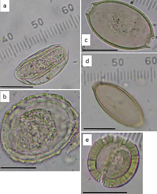 Αυγά εντερικών παρασίτων που ανακτήθηκαν από τα ιζήματα που συλλέχθηκαν κάτω από το λίθινο κάθισμα αποχωρητηρίου στην συνοικία Armon Hanatziv. (a). Enterobius vermicularis; (b). Ascaris lumbricoides; (c). Trichuris suis; (d). Trichuris trichiura; (e). Taenia sp. Κλίμακα = 25 micron [Credit: Eitan Kremer]