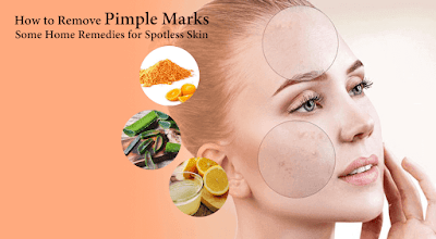 How to Remove Pimple Marks