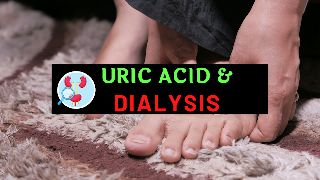 does dialysis remove uric acid