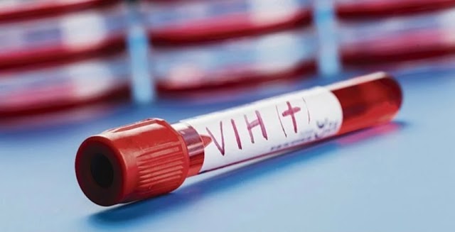 Interesante:Identifican segundo paciente con VIH no tratado que se cura del virus