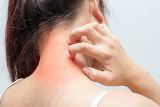 TESTE DE ALERGIA A MEDICAMENTO