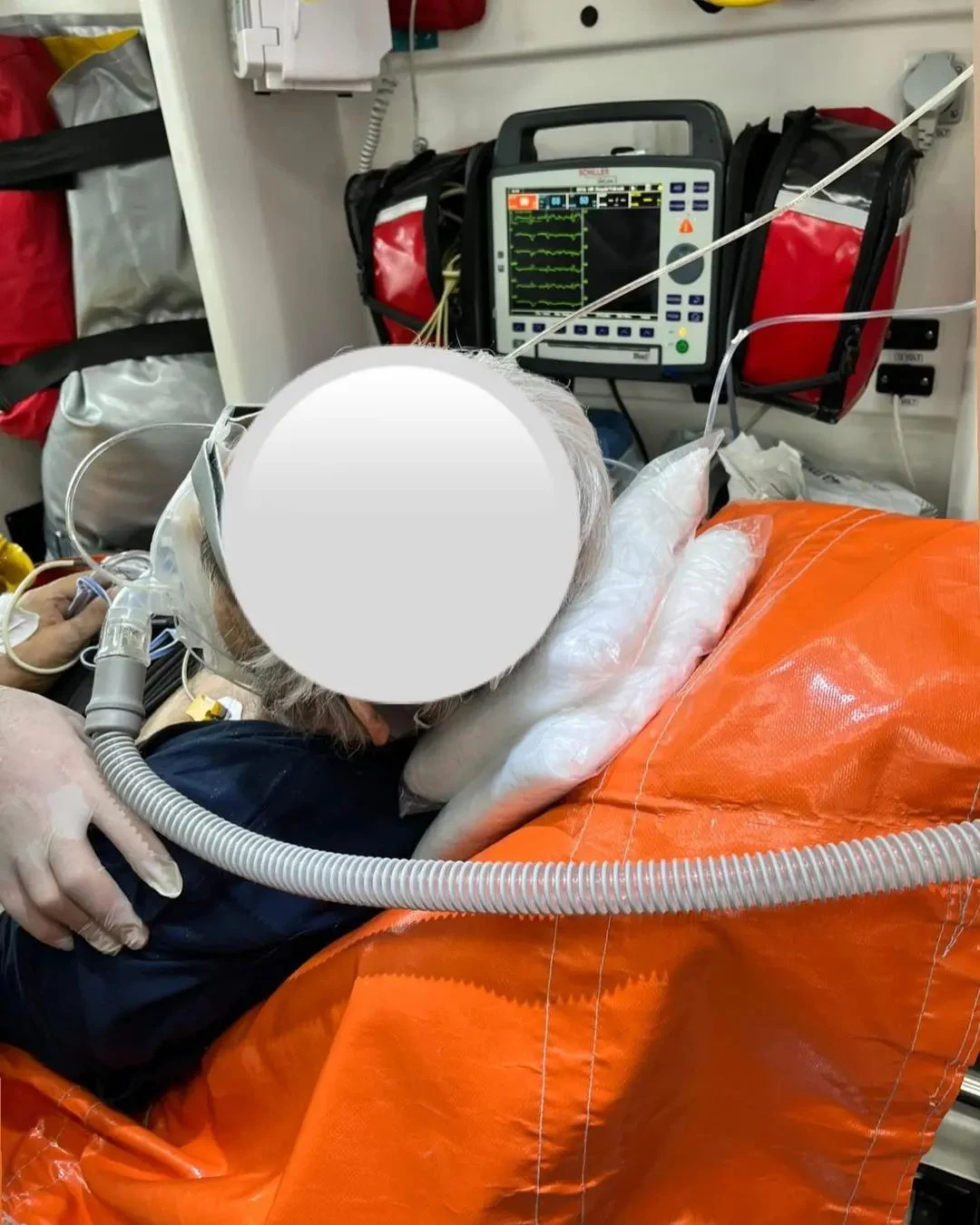 hipoksi-cpap