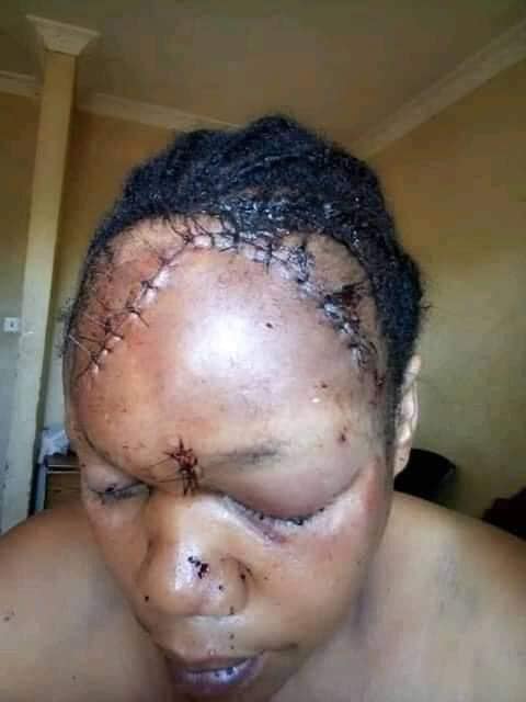 Disastrous! Husband dismantle His Wife Face Some Weeks after their marriage (Photos)