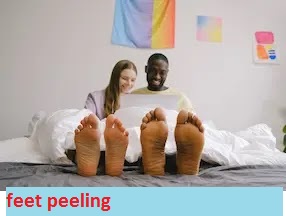 feet peeling