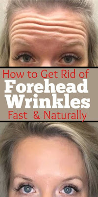 How To Get Rid Of Forehead Wrinkles