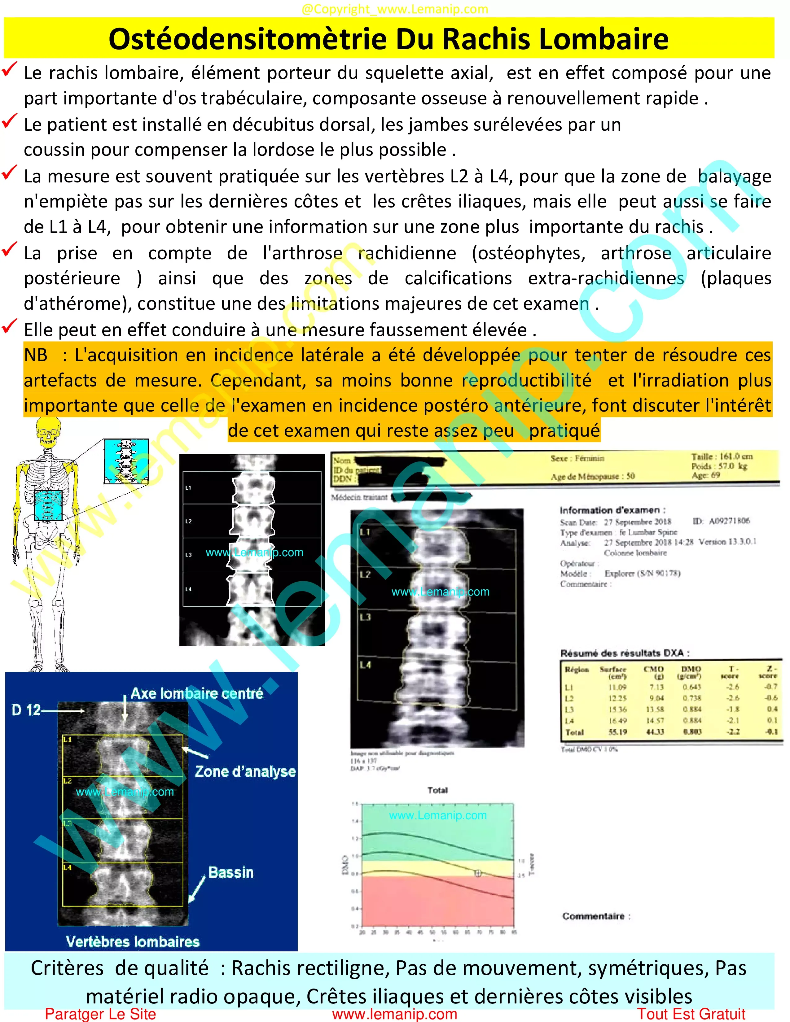 Ostéodensitomètrie Du Rachis Lombaire