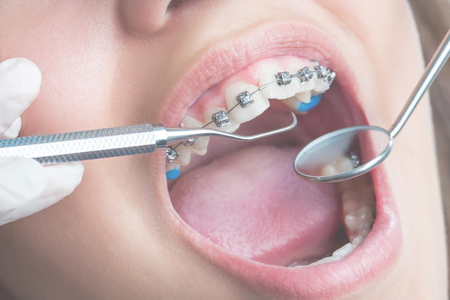 Best Orthodontist in Ahmedabad