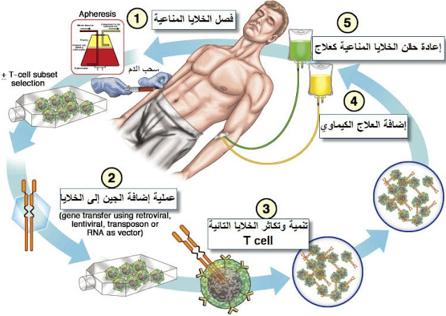 طريقة علاج السرطان بالخلايا المناعية CAR T cells