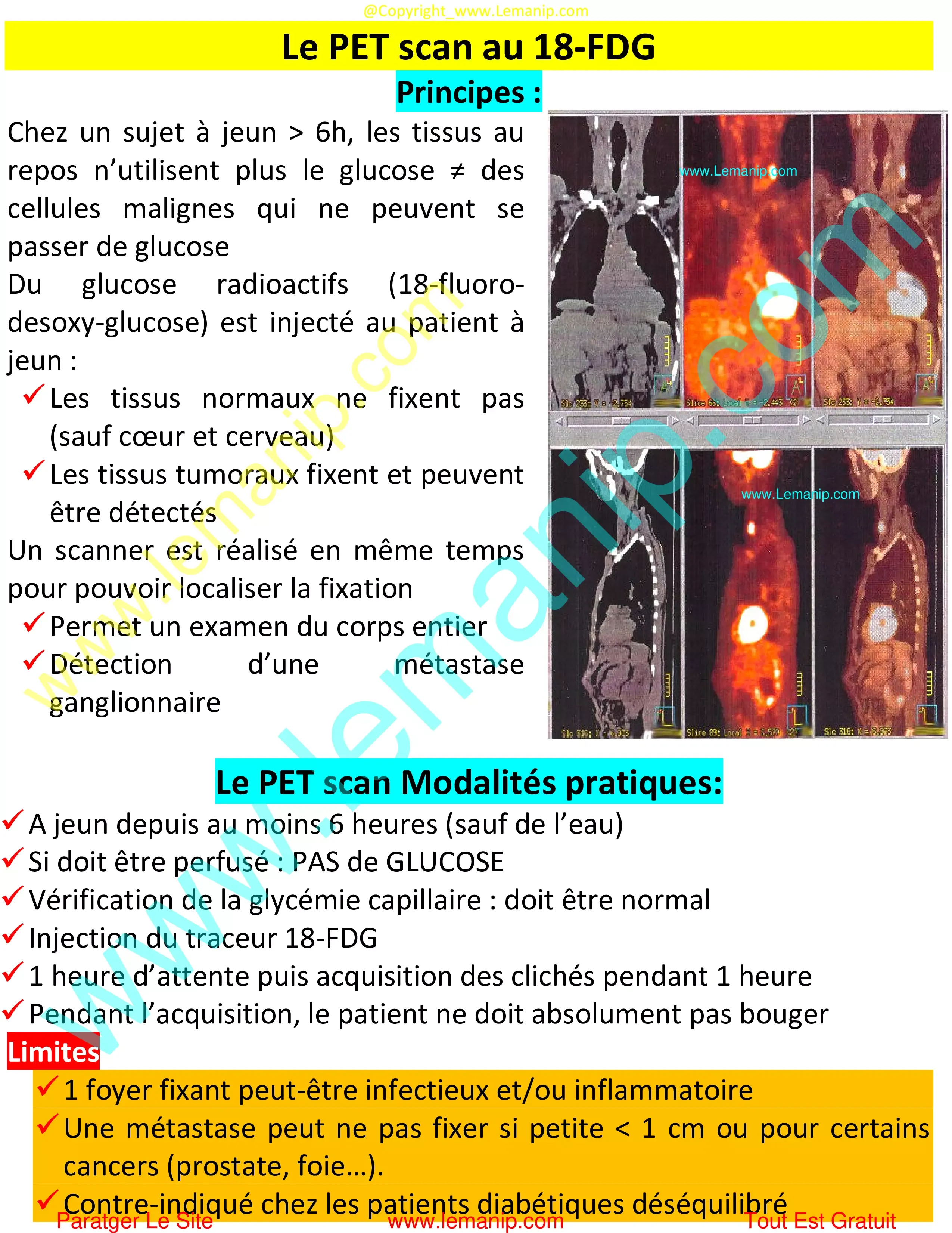 PET scan au 18-FDG