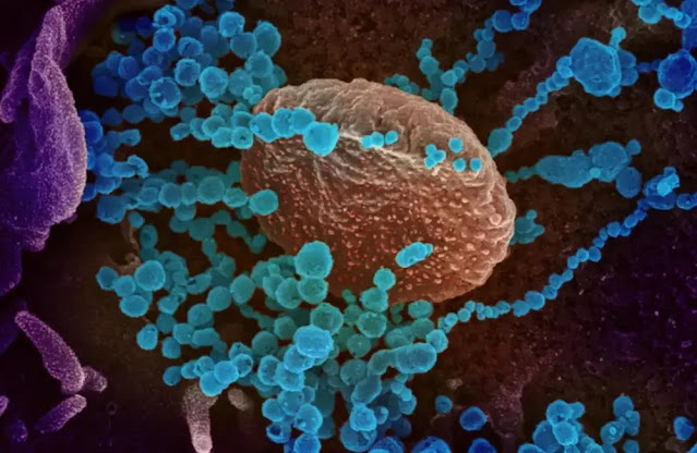 A microscope image of the SARS-CoV-2 virus. Photo: U.S NIAID-RML / REUTERS