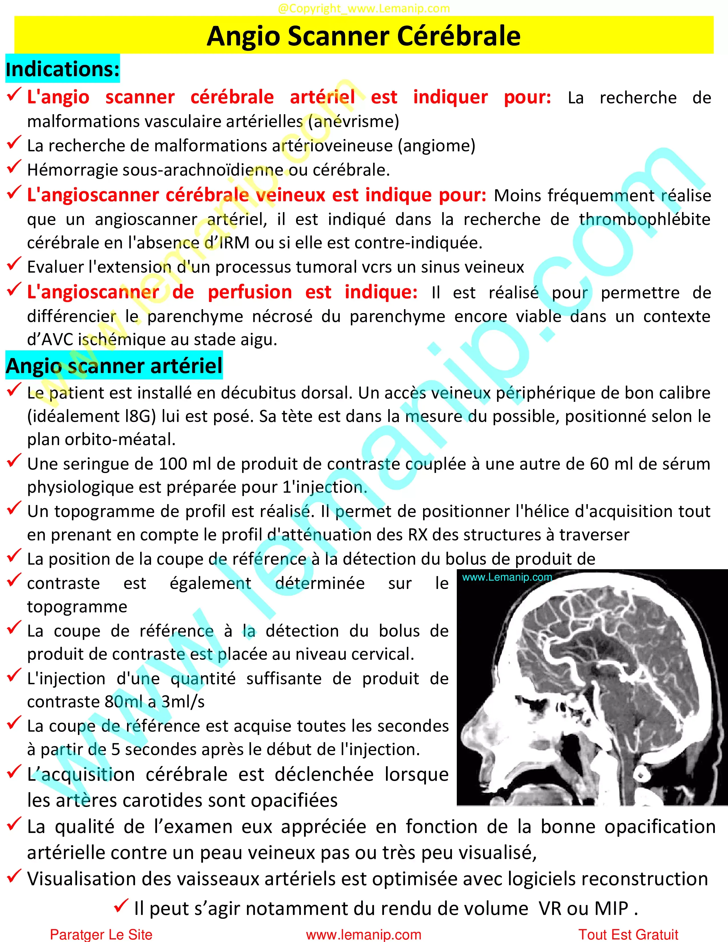 Angio Scanner Cérébrale