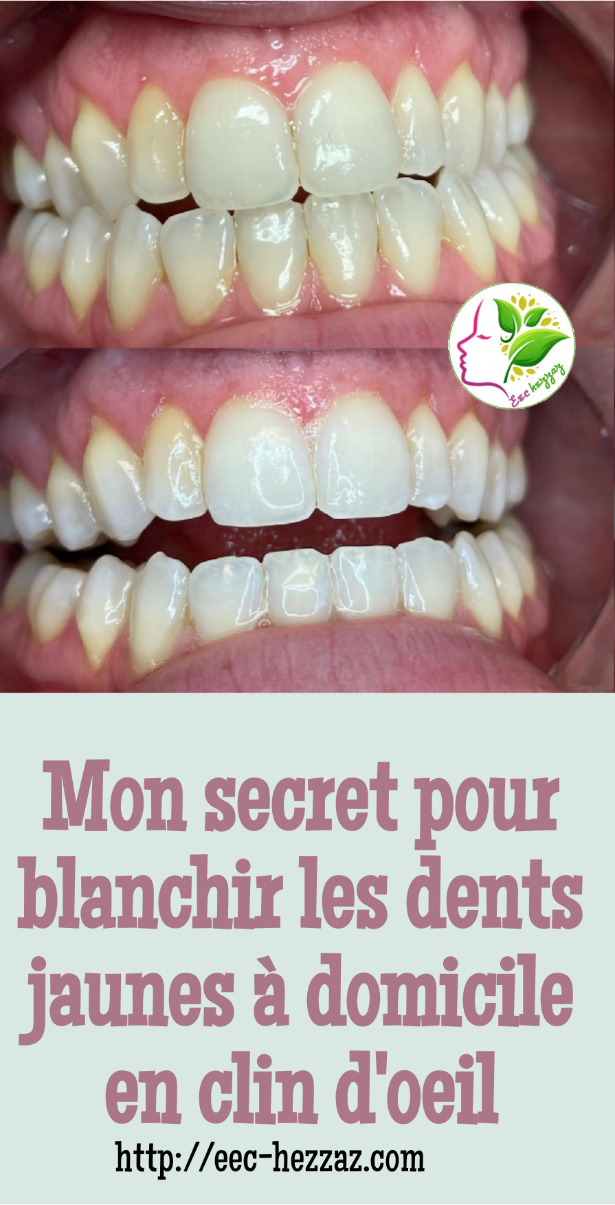 Mon secret pour blanchir les dents jaunes à domicile en clin d'oeil