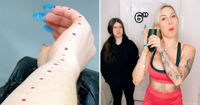 34-year-old, Tracy Kiss boasted a new tattoo to her millions of followers of dots running down the length of her arm.